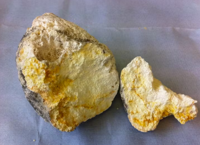 Ambergris (Whale Vomit) - Image 5