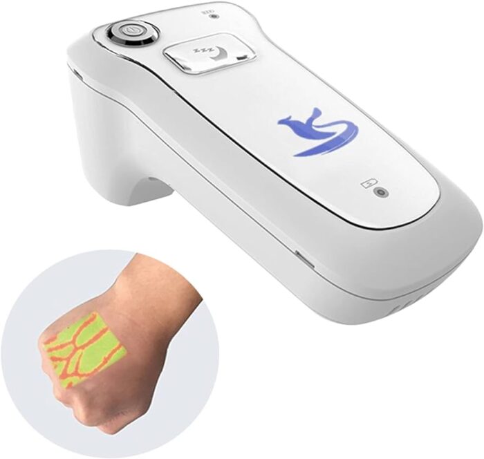 Vein visualization systems - Image 2