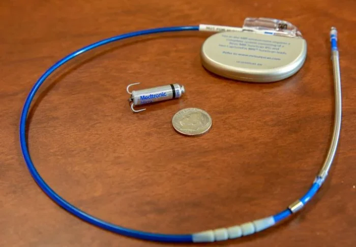 Pacemakers - Image 2