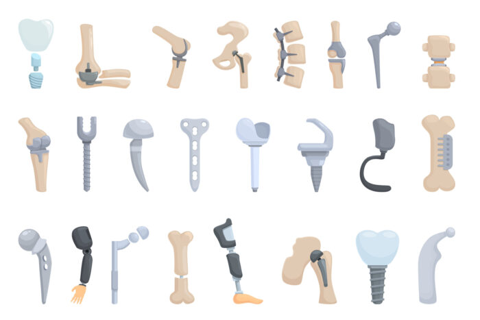 Orthopedic implants and tools - Image 5