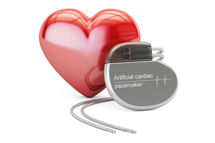 Pacemakers